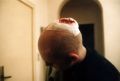 Hole in da head.jpg